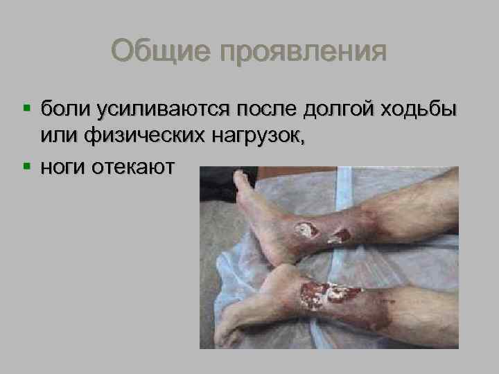  Основные эффекты  компрессионного трикотажа улучшение венозного и лимфатического  оттока от нижних