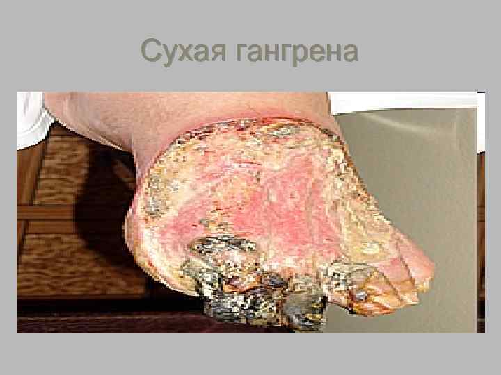        На фото представлен тот же пациент, что