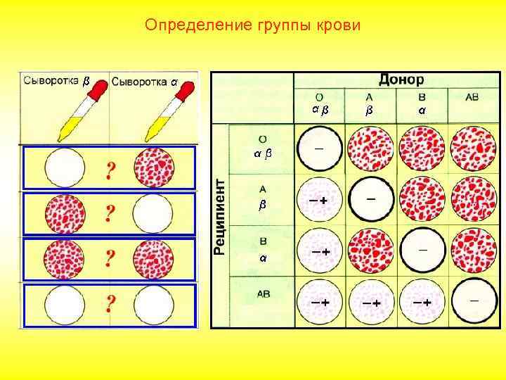 Гемотрансфузионный шок, резус-конфликт   1940 году К. Ландштейнер обнаружил,   что 85%