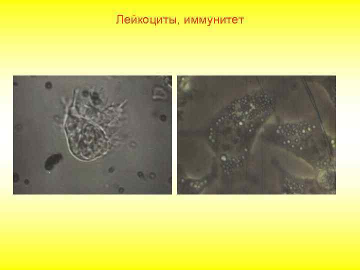 Лейкоциты, иммунитет 