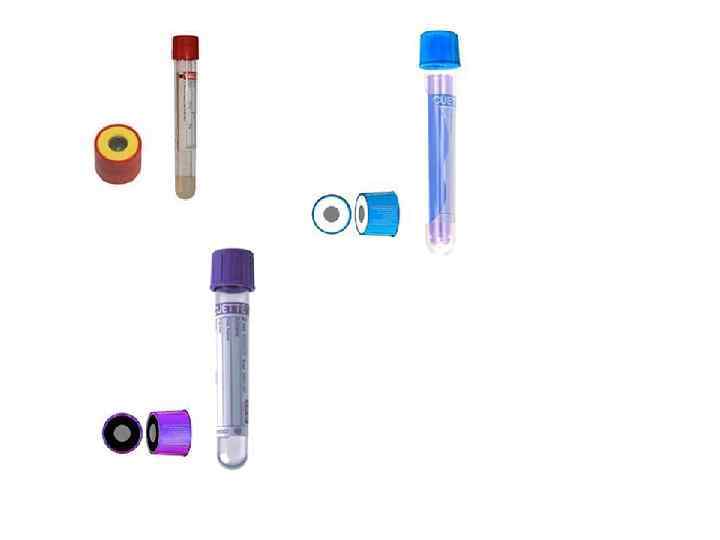   Венозная кровь • Взятие крови шприцом без антикоагулянта с  последующим переливанием