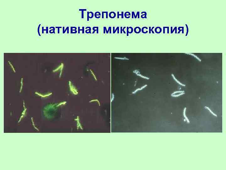  Трепонема (нативная микроскопия) 