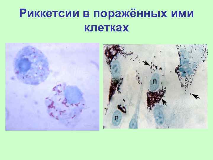 Риккетсии в поражённых ими  клетках 