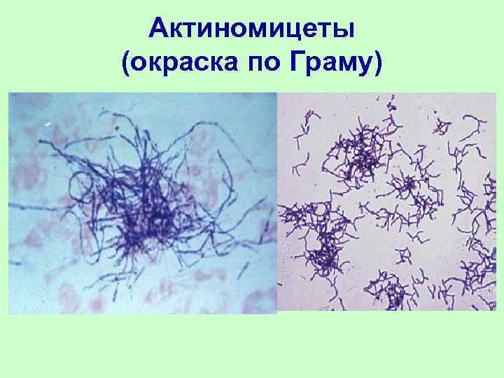  Актиномицеты (окраска по Граму) 