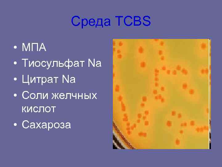 Среда TCBS • МПА • Тиосульфат Na • Цитрат Na • Среда TCBS • МПА • Тиосульфат Na • Цитрат Na •