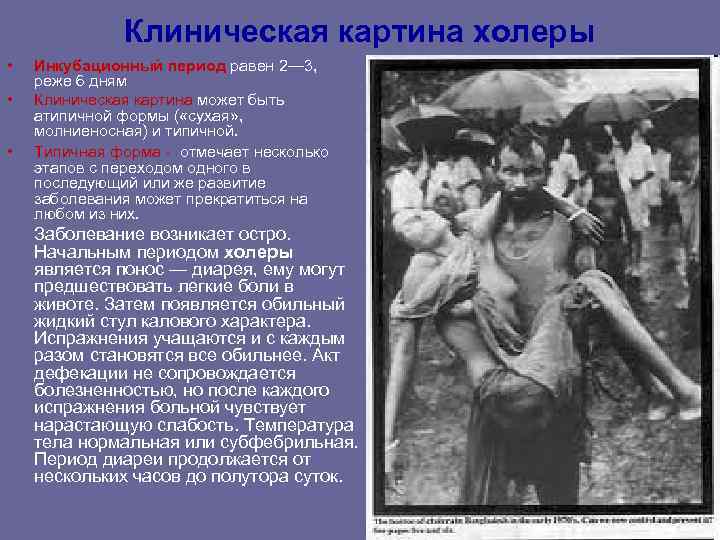Клиническая картина холеры • Инкубационный период равен 2— 3, Клиническая картина холеры • Инкубационный период равен 2— 3,