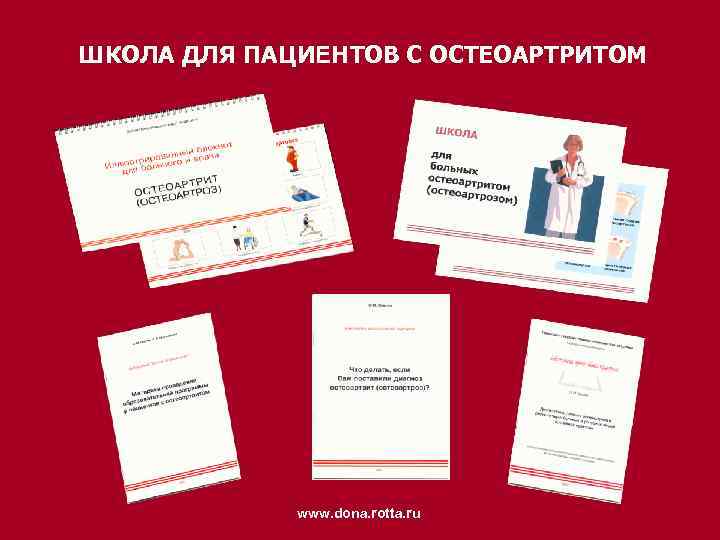 ШКОЛА ДЛЯ ПАЦИЕНТОВ С ОСТЕОАРТРИТОМ www. dona. rotta. ru 