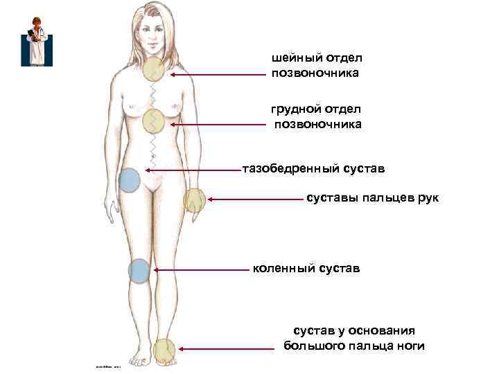  шейный отдел позвоночника грудной отдел позвоночника тазобедренный сустав суставы пальцев рук коленный сустав