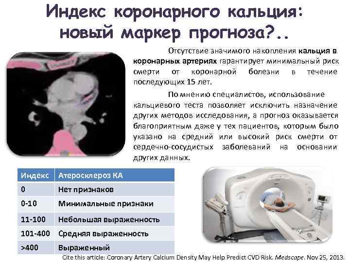    Индекс коронарного кальция:  новый маркер прогноза? . .  