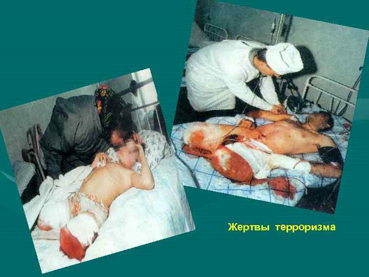 Таких   могил   много 