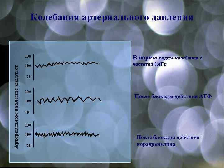  Колебания артериального давления 130 В норме: видны колебания с 100 частотой 0. 4