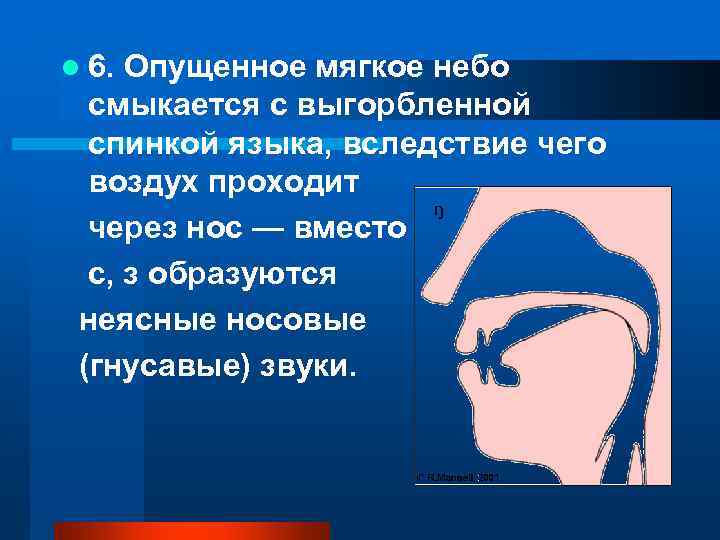 l 6. Опущенное мягкое небо смыкается с выгорбленной спинкой языка, вследствие чего воздух проходит