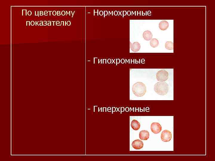 Анемия цветной показатель. Нормохромные нормоцитарные анемии. Нормохромная анемия показатели. Гиперхромная анемия. Нормохромные гипохромные эритроциты.
