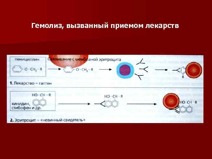 Гемолиз и его виды