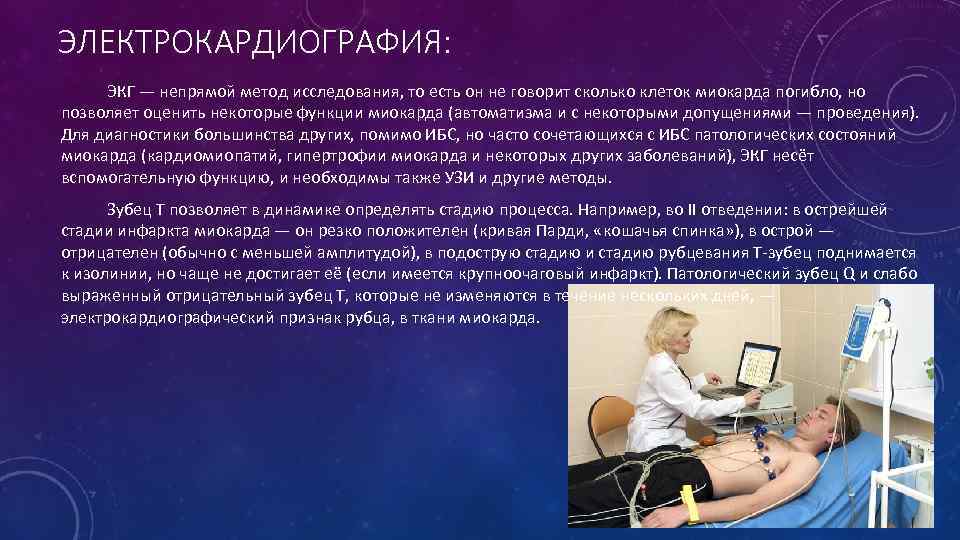  ЭЛЕКТРОКАРДИОГРАФИЯ:    ЭКГ — непрямой метод исследования, то есть он не