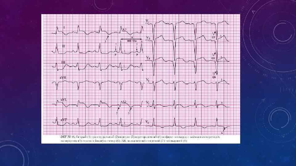  • Эхокардиография. Суть метода заключается в облучении тканей импульсами ультразвука  фиксированной частоты