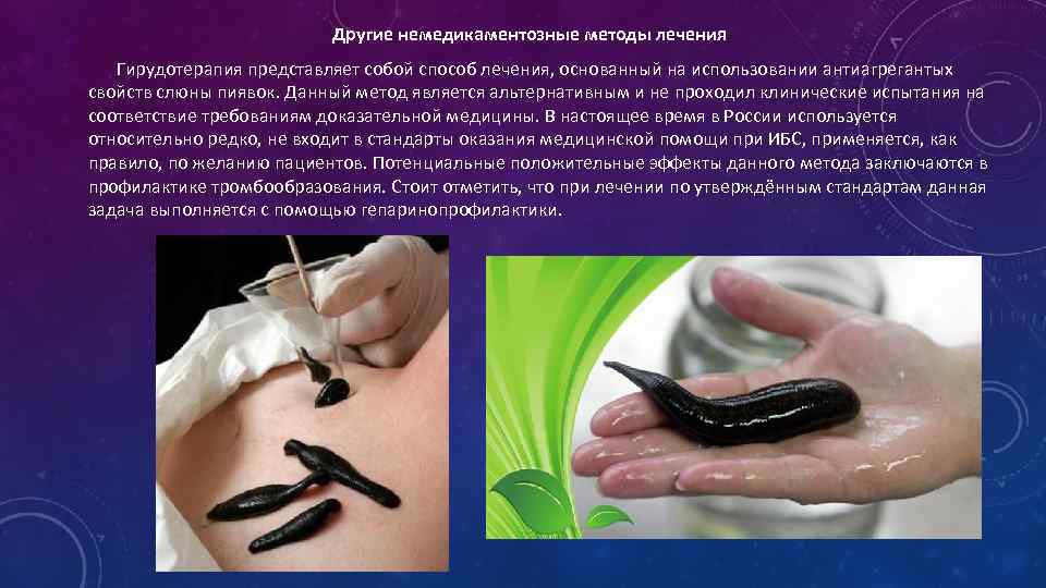 Метод ударно-волновой терапии Воздействие ударных волн низкой мощности приводит к реваскуляризации миокарда. Экстракорпоральный 