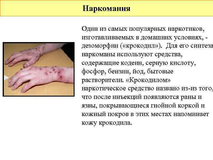 Наркомания Один из самых популярных наркотиков, изготавливаемых в домашних условиях, - дезоморфин ( «крокодил»
