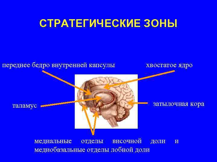   СТРАТЕГИЧЕСКИЕ ЗОНЫ  переднее бедро внутренней капсулы  хвостатое ядро  таламус