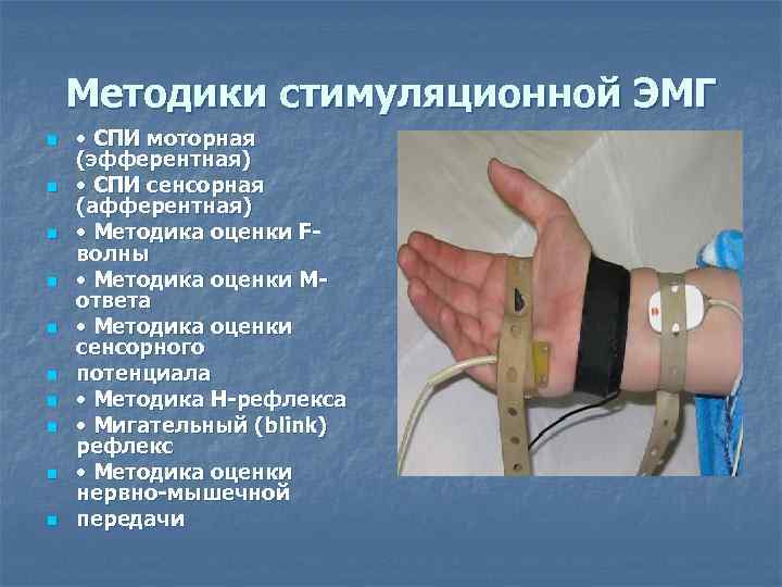   Методики стимуляционной ЭМГ n  • СПИ моторная (эфферентная) n  •