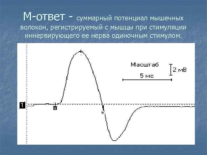 М-ответ - суммарный потенциал мышечных волокон, регистрируемый с мышцы при стимуляции иннервирующего ее нерва
