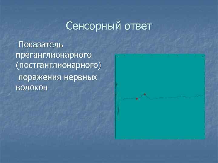   Сенсорный ответ Показатель преганглионарного (постганглионарного) поражения нервных волокон 