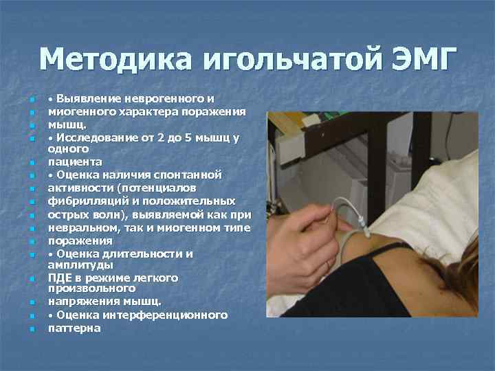   Методика игольчатой ЭМГ n  • Выявление неврогенного и n  миогенного