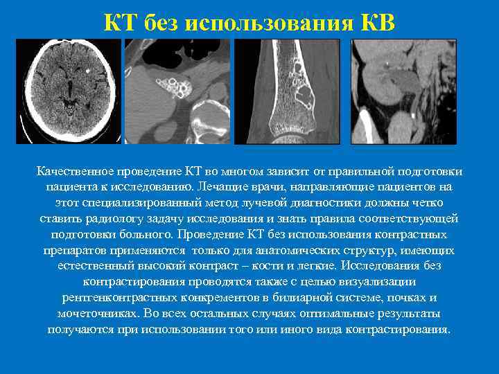  КТ без использования КВ Качественное проведение КТ во многом зависит от правильной подготовки