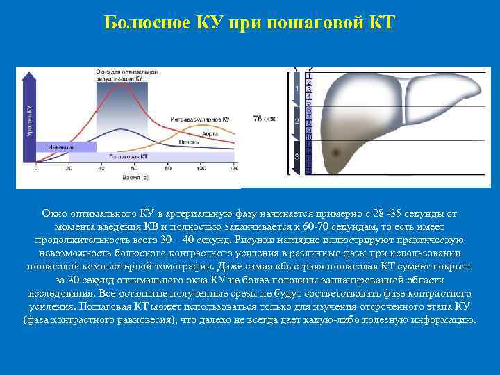  Болюсное КУ при пошаговой КТ Окно оптимального КУ в артериальную фазу начинается примерно