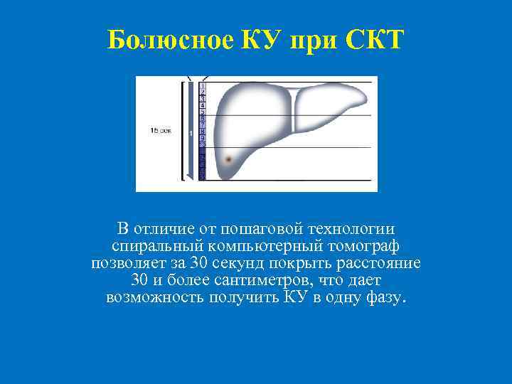  Болюсное КУ при СКТ В отличие от пошаговой технологии спиральный компьютерный томограф позволяет