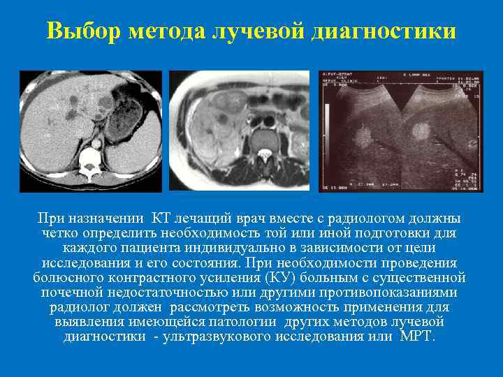  Выбор метода лучевой диагностики При назначении КТ лечащий врач вместе с радиологом должны