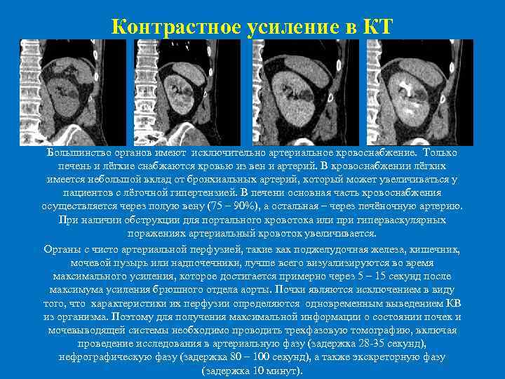  Контрастное усиление в КТ Большинство органов имеют исключительно артериальное кровоснабжение. Только печень и