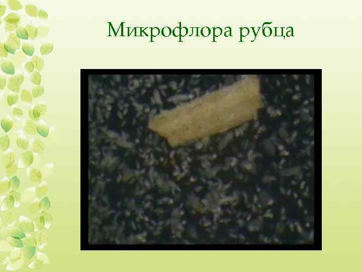 Микрофлора рубца 