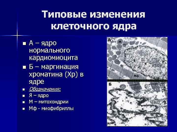 Изменения клеток. Маргинация хроматина. Конденсация и маргинация хроматина. Патофизиология хроматин маргинация. Изменения ядра клетки.