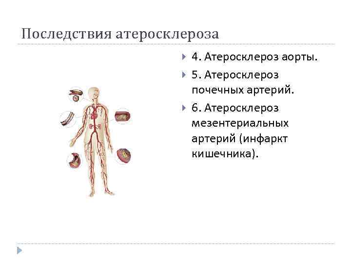 Атеросклероз аорты и артерий