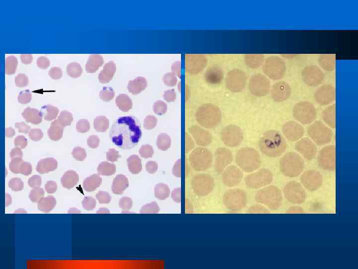 Систематика паразита Царство Protista =Protozoa Тип   Apicomplexa Класс  Sporozoa Отряд 