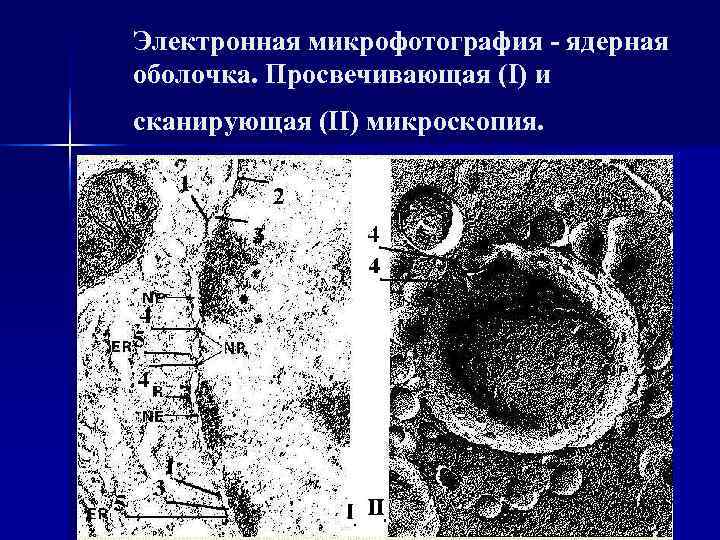 Электронная микрофотография - ядерная оболочка. Просвечивающая (I) и сканирующая (II) микроскопия. 