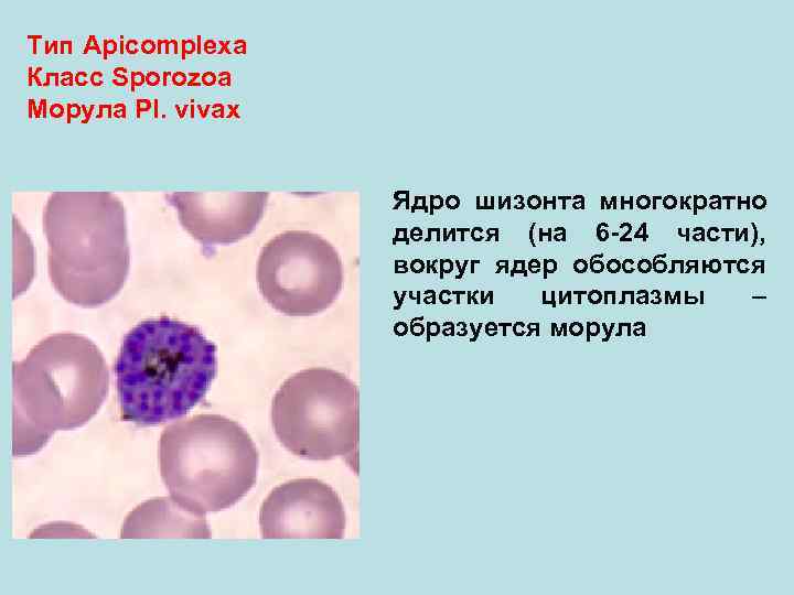 Тип Аpicomplexa Класс Sporozoa Морула Pl. vivax Ядро шизонта многократно делится (на 6 -24