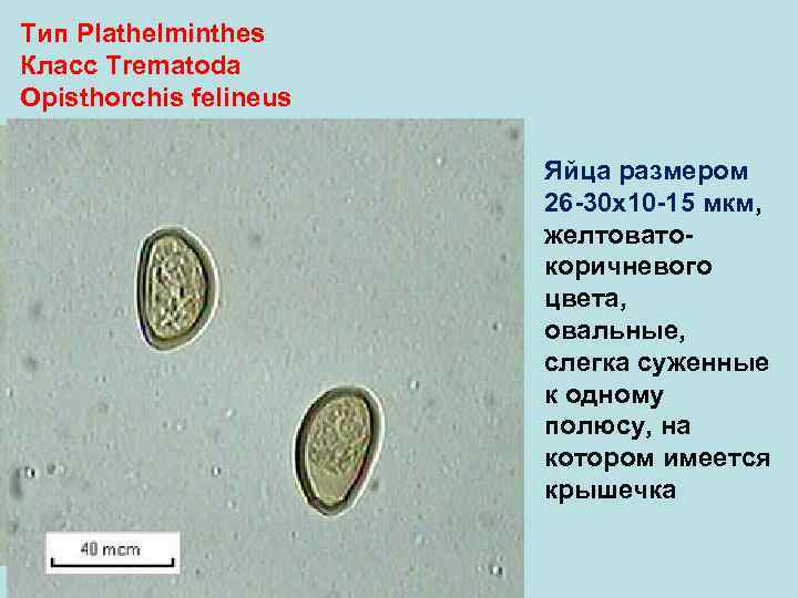 Тип Plathelminthes Класс Trematoda Opisthorchis felineus Яйца размером 26 -30 х10 -15 мкм, желтовато-