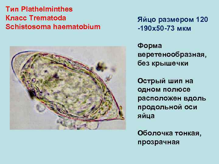 Тип Plathelminthes Класс Trematoda Яйцо размером 120 Schistosoma haematobium -190 х50 -73 мкм Форма