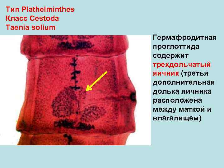 Тип Plathelminthes Класс Cestoda Taenia solium Гермафродитная проглоттида содержит трехдольчатый яичник (третья дополнительная долька