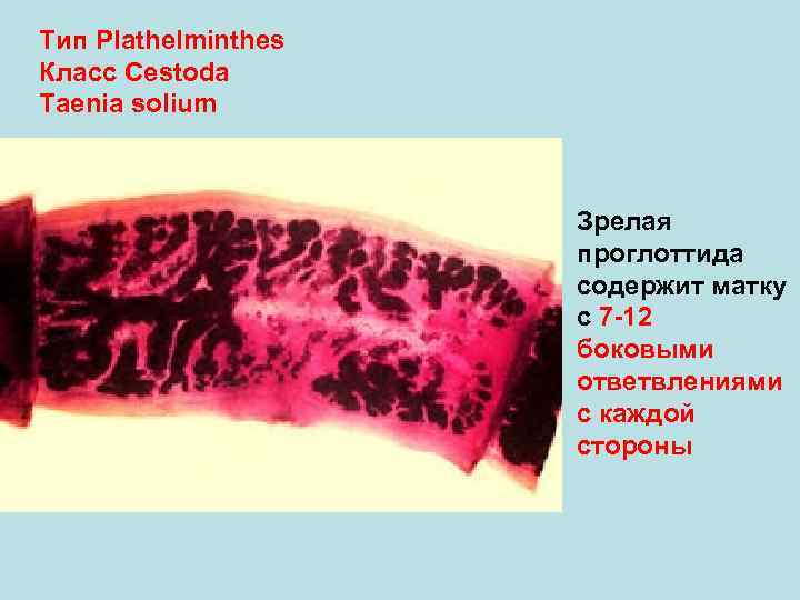 Тип Plathelminthes Класс Cestoda Taenia solium Зрелая проглоттида содержит матку с 7 -12 боковыми