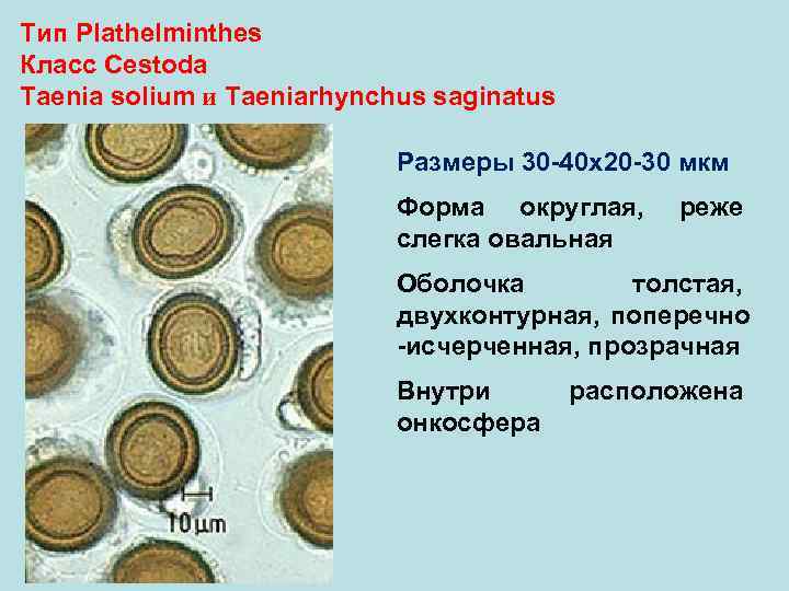 Тип Plathelminthes Класс Cestoda Taenia solium и Taeniarhynchus saginatus Размеры 30 -40 х20 -30