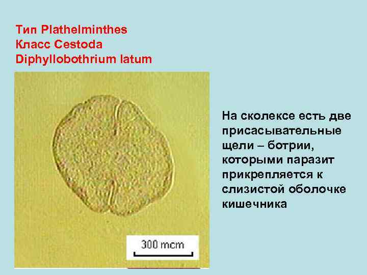 Тип Plathelminthes Класс Cestoda Diphyllobothrium latum На сколексе есть две присасывательные щели – ботрии,