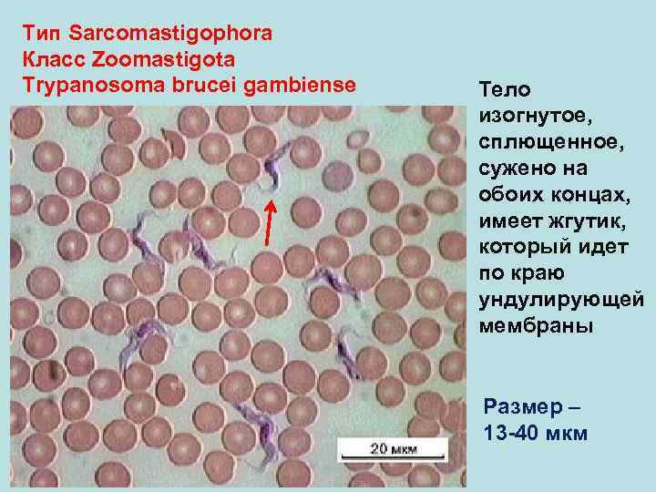 Тип Sarcomastigophora Класс Zoomastigota Trypanosoma brucei gambiense Тело изогнутое, сплющенное, сужено на обоих концах,