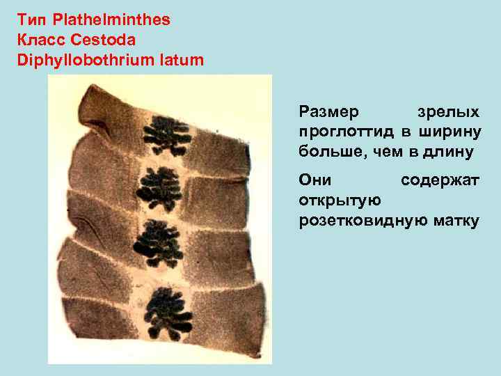 Тип Plathelminthes Класс Cestoda Diphyllobothrium latum Размер зрелых проглоттид в ширину больше, чем в