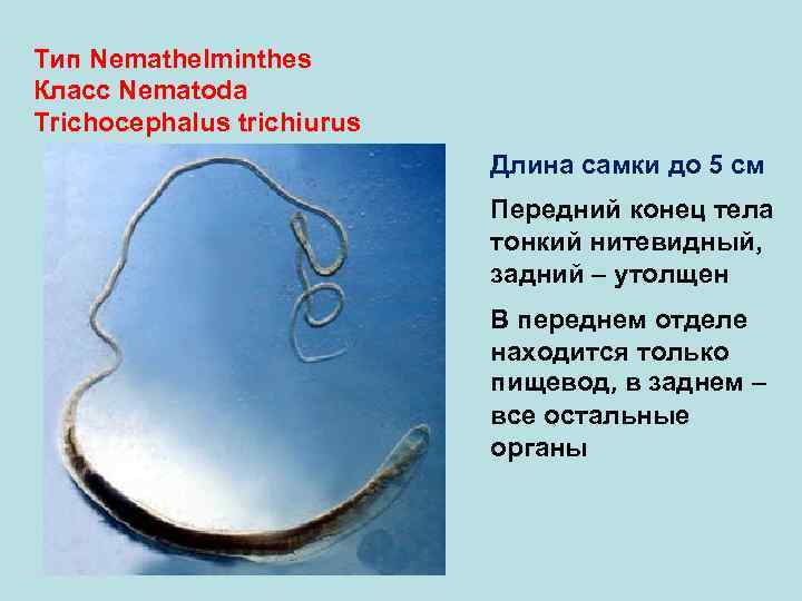 Тип Nemathelminthes Класс Nematoda Trichocephalus trichiurus Длина самки до 5 см Передний конец тела