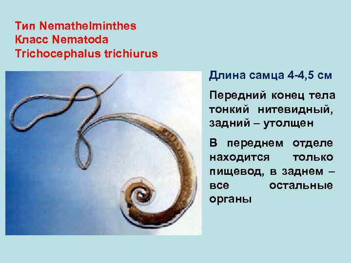 Тип Nemathelminthes Класс Nematoda Trichocephalus trichiurus Длина самца 4 -4, 5 см Передний конец