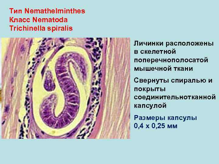 Тип Nemathelminthes Класс Nematoda Trichinella spiralis Личинки расположены в скелетной поперечнополосатой мышечной ткани Свернуты