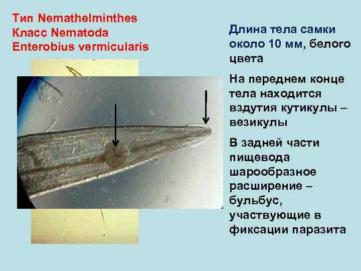 Тип Nemathelminthes Класс Nematoda Длина тела самки Enterobius vermicularis около 10 мм, белого цвета